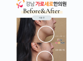 하이푸