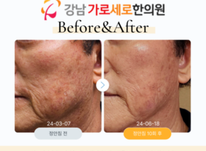 정안침 10회