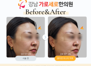 콜라겐부스터