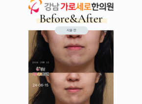 하이푸