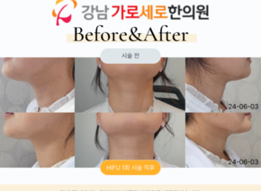 하이푸