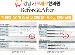  [-8.9kg] 습담개선탕 복용 전후 인바디