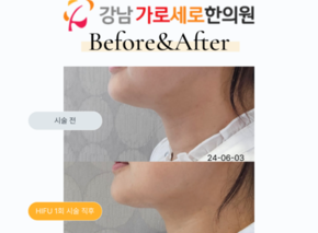 하이푸
