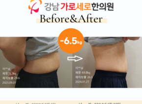 [-6.5kg] 습담개선탕 복용 비포애프터