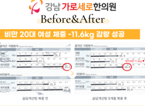  [-11.6kg] 습담개선탕 복용 전후 인바디