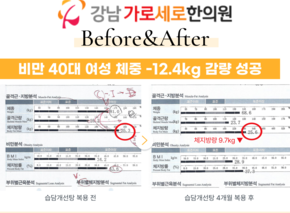[-12.4kg] 습담개선탕 복용 전후 인바디