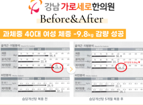 [-9.8kg] 습담개선탕 복용 전후 인바디