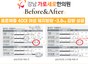  [-3.8kg] 습담개선탕 복용 전후 인바디