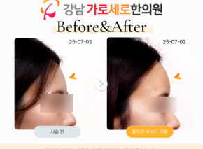 콜라겐부스터