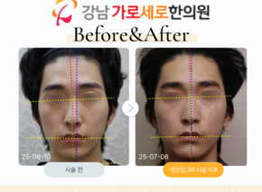 정안침 3회