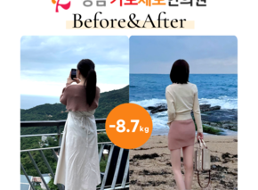 [-8.7kg] 습담개선탕 복용 전후사진