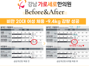  [-9.4kg] 습담개선탕 복용 전후 인바디