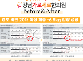 [-6.5kg] 습담개선탕 복용 전후 인바디