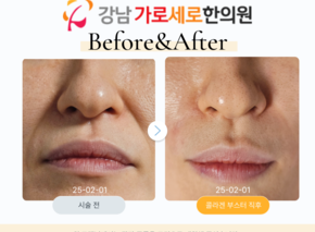 콜라겐 부스터
