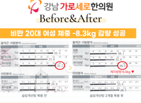[-8.3kg] 습담개선탕 복용 전후 인바디