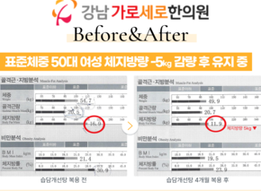 [-5kg] 습담개선탕 복용 전후 인바디