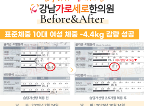  [-4.4kg] 습담개선탕 복용 전후 인바디