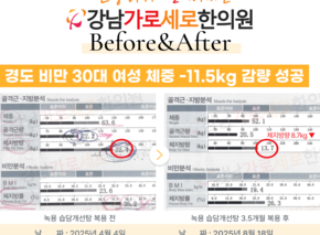  [-11.5kg] 녹용 습담개선탕 복용 전후 인바디