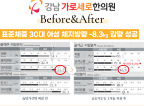[-8.3kg] 습담개선탕 복용 전후 인바디