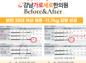  [-11.7kg] 습담개선탕 복용 전후 인바디