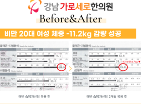 [-11.2kg] 태반 습담개선탕 복용 전후 인바디