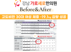  [-19.1kg] 습담개선탕 복용 전후 인바디