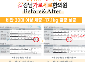  [-17.5kg] 습담개선탕 복용 전후사진