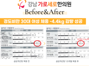  [-4.4kg] 습담개선탕 복용 전후 인바디