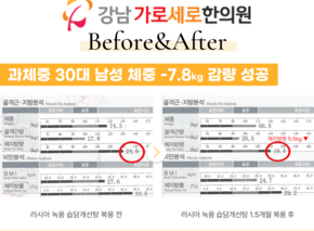 [-7.8kg] 러시아 녹용 습담개선탕 복용 전후 인바디