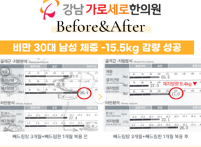  [-15.5kg] 빼드림탕+빼드림환 복용 전후 인바디