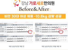 [-10.8kg] 태반 습담개선탕 복용 전후 인바디