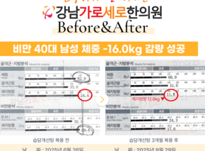 [-16.0kg] 습담개선탕 복용 전후사진
