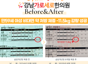 [-11.5kg] 습담개선탕 복용 전후
