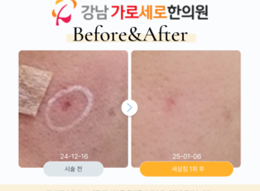 새살침 1회