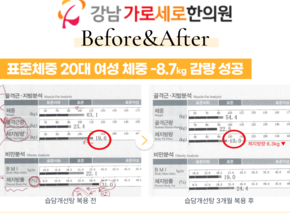 [-8.7kg] 습담개선탕 복용 전후 인바디