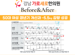 [-5.5kg] 태반 습담개선탕 복용 전후 인바디