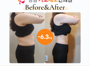[-6.3kg] 습담개선탕 복용 비포애프터