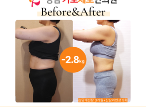 [-2.8kg] 습담개선탕 복용(+산삼라인샷 5회) 비포애프터