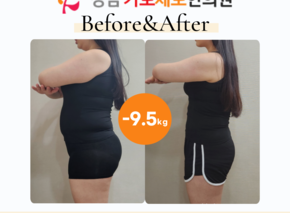 [-9.5kg] 습담개선탕 복용 전후사진