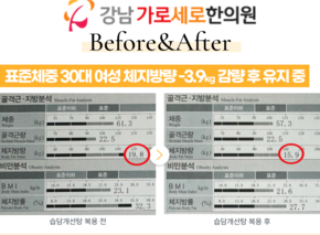 [-3.9kg] 습담개선탕 복용 전후 인바디