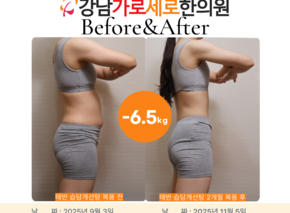 [-6.5kg] 태반 습담개선탕 2개월만에 6.5kg 감량