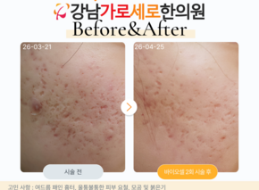 [30대 여성] 바이오필