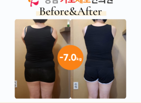 [-7.0kg] 습담개선탕 복용 전후사진
