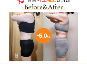 [-5.0kg] 습담개선탕 복용 비포애프터