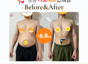 [-6.8kg] 습담개선탕 복용 전후사진