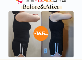 [-16.5kg] 습담개선탕 복용 전후사진